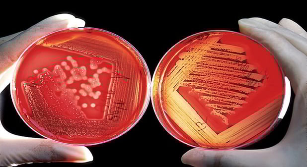 Cesión de datos a los registros de cáncer